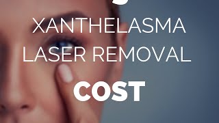 Xanthelasma laser removal cost is it worth it [upl. by Babbette727]