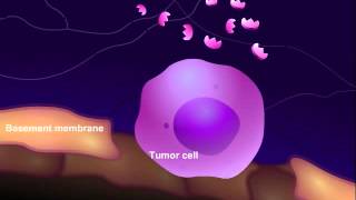 Introduction to Cancer Biology Part 3 Tissue Invasion and Metastasis [upl. by Ajidahk]