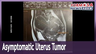 A uterus tumor can have no symptoms so get regular checks doctors [upl. by Penoyer]