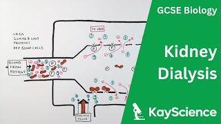 Kidney Dialysis  Biology GCSE  kaysciencecom [upl. by Inoj]