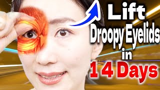 Do this Before Seeing Friends Ultimate Massage to Lift Droopy Eyelids in 14 Days [upl. by Anafetse95]