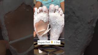 Repair Cracked Heels In 1Day  Get Rid Of Dry Feet  Get Fair amp Soft Feet Instantly cracked shorts [upl. by Siroval]