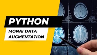 3D Volumes Augmentation for Tumor Segmentation Using Python amp MONAI [upl. by Jaqitsch1]