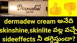 Dermadew cream అనేది skinshineskinlite creams వల్ల వచ్చే sideeffects నీ తగ్గిస్తుందాdermadew [upl. by Latia]