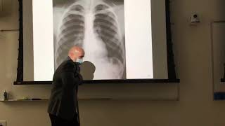 Chest xray positioning [upl. by Miguel]