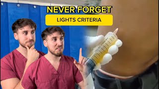 Easily remember Lights criteria with this simple mnemonic [upl. by Esinyt]