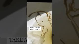 Anti Parasite Removal Detox Parasite during colonic Get rid of gut parasites [upl. by Frederiksen707]