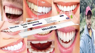 Masofta Teeth Whitening Pen  Honest Review [upl. by Simson]