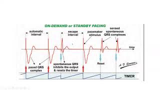 Pacemaker timing cycles and special features  Dr Mohamed Bayoumi [upl. by Aer]