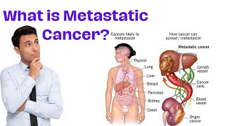 Understanding Metastasis  What is Metastatic Cancer [upl. by Inneg]