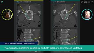 VUZE Medical Showcases Concurrent MultiTool 3D Guidance in Spine Surgery With No Navigational [upl. by Attennod]