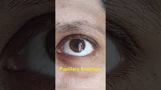 Pupillary reaction in eye [upl. by Sirdna]