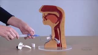 Tracheostomy  Respiratory phonatory and swallowing function  TRACS WA [upl. by Ahsatel]