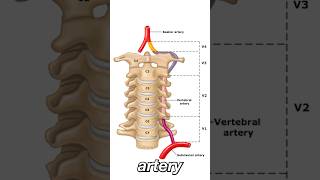 Vertebral Artery Dissection [upl. by Enomahs967]