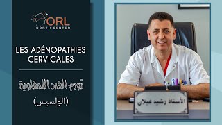 Les adénopathies cervicales تورم الغدد اللمفاوية الولسيس [upl. by Malcom]