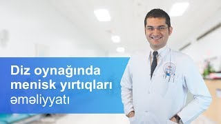 Diz oynağında menisk yırtıqları əməliyyatı  Travmatoloqortoped  Uzm Şəhriyar Fətullayev [upl. by Dahcir261]