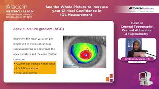 Topic 2 Basic in Corneal Topography Corneal Abberation amp Pupillometry  Dini Dharmawidiarini MD [upl. by Sidney882]