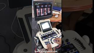 MSLCU46 4d abdominal ultrasound machine device operation [upl. by Ecart]