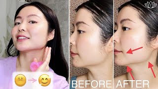 Cupping Massage For Double Chin Jawline Marionette Lines Effective amp NO Surgery  BEFORE amp AFTER [upl. by Iolenta183]