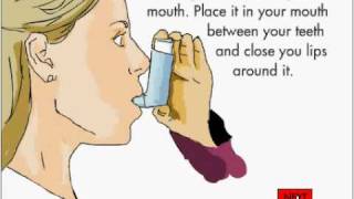 How to use an Inhaler [upl. by Barbe209]