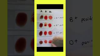 Blood grouping A positive group B positive group O positive blood group [upl. by Anaihsat613]