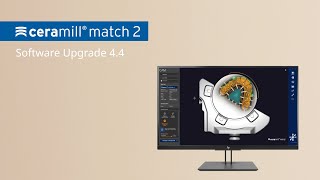 Ceramill Upgrade 44  Ceramill Match 2 [upl. by Mil]