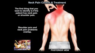 Neck Pain Causes and Treatment  Everything You Need To Know  Dr Nabil Ebraheim [upl. by Lyssa]