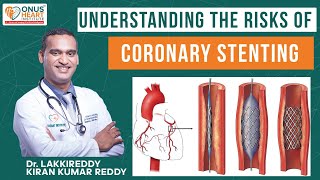 quotUnderstanding the Risks of Coronary Stenting Explained by Dr Lakkireddyquot [upl. by Lanuk708]