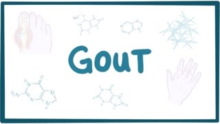 Gout  causes symptoms diagnosis treatment pathology [upl. by Arrio466]