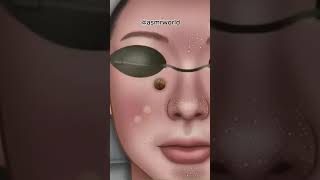 Fast asmr⚡️removing blackheads asmr animation satisfyingvideo viralshorts [upl. by Dania]