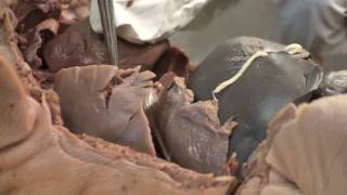 Fetal Pig Dissection  Locations and Review of Heart Parts [upl. by Remus644]