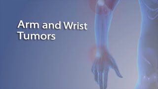 Arm and Wrist Tumors  FAQ with Dr Sophia Strike [upl. by Mackoff]