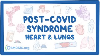 PostCOVID syndrome Heart and lungs [upl. by Amii]