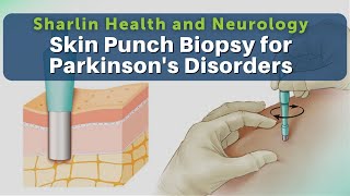 Get to Know About Skin Punch Biopsy for Alpha Synuclein Protein at Sharlin Health and Neurology [upl. by Funk]