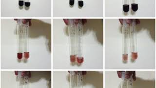 Alpha amylase colour development in assay determination [upl. by Ekrub]