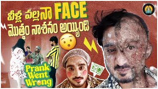 వీళ్ల వల్ల నా Face మొత్తం నాశనం అయ్యింది 😲 Prank Went Wrong  Lollas World [upl. by Adiene434]