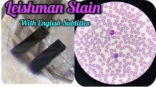 Leishman Stain ProcedurePBS Blood Smear PreparationHaematologyDLC Count themedilab [upl. by Eecrad]