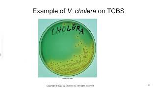 Vibrio Aeromonas and Campylobacter [upl. by Adai]