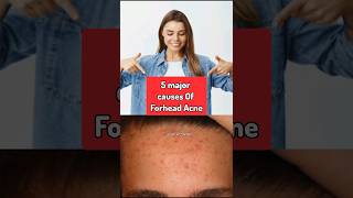 Causes Of Forhead Acne❓shorts forheadacne acnescars trendingshorts viralshorts subscribe [upl. by Munafo395]