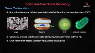 Adenosine deaminase ADA deficiency [upl. by Devinna686]