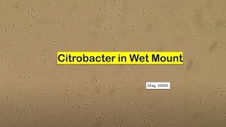 Citrobacter in Wet mount of Culture Microscopy [upl. by Moyna]