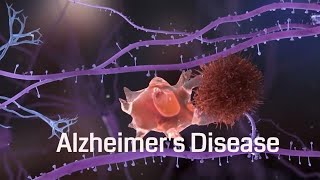 Alzheimers disease Pathophysiology and causes [upl. by Gautious]