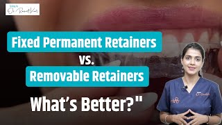 Permanent Retainer vs Removable Retainer  Which is better   Orthodontist in Gurgaon [upl. by Annnora831]