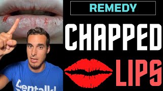 CHAPPED LIPS  Causes and REMEDIES for cracked lips [upl. by Ykcir888]