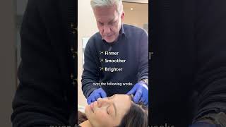 Bio Remodelling Skin Treatment in Sydney  Collagen Stimulation [upl. by Thurber]