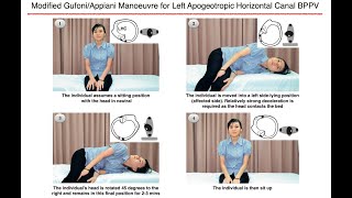 Modified GufoniAppiani Manoeuvre for Left Apogeotropic Horizontal Canal BPPV [upl. by Luanne502]