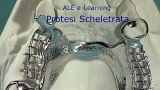 ALE eLearning  03  Protesi Scheletrata [upl. by Schlessinger]