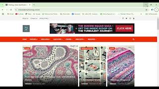 Histology Slides Identification Points Google Chrome 2024 11 17 12 56 47 [upl. by Creedon]