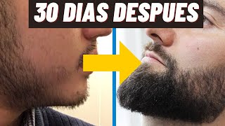 Las ÚNICAS Forma De Crecer La Barba En 30 Días [upl. by Haidabez]