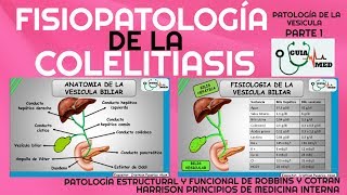 COLELITIASIS FISIOPATOLOGÍA GuiaMed [upl. by Stultz]